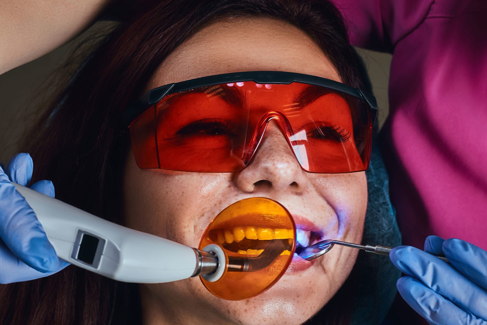 Tooth Bonding 1 Rated Central Austin Cosmetic Dentist